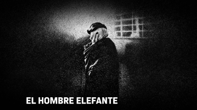 El hombre elefante
